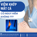 3.VIÊM KHỚP MẮC CÁ 24.07.23
