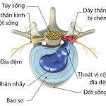 thoat-vi-dia-dem