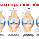 CAPCUT (1920 x 1080 px) (14)