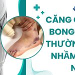 CĂNG CƠ VÀ BONG GÂN