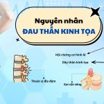 Dây thần kinh tọa